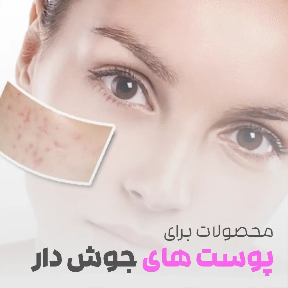 پوست جوش دار